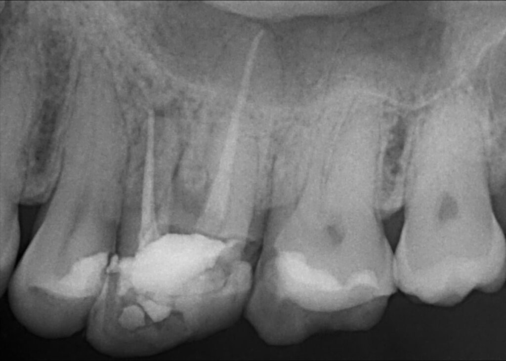 intraoralna 1